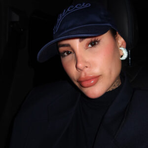 Lip lift in Turkey upper lip balance before and after result