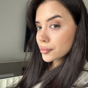 Brow lift in Turkey eyebrow repositioning before and after result